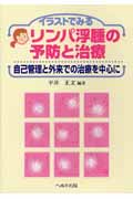 リンパ浮腫の予防と治療 自己管理と外来での治療を中心に